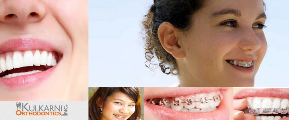 Kulkarni Orthodontics - Professional dental clinic exterior with modern facilities