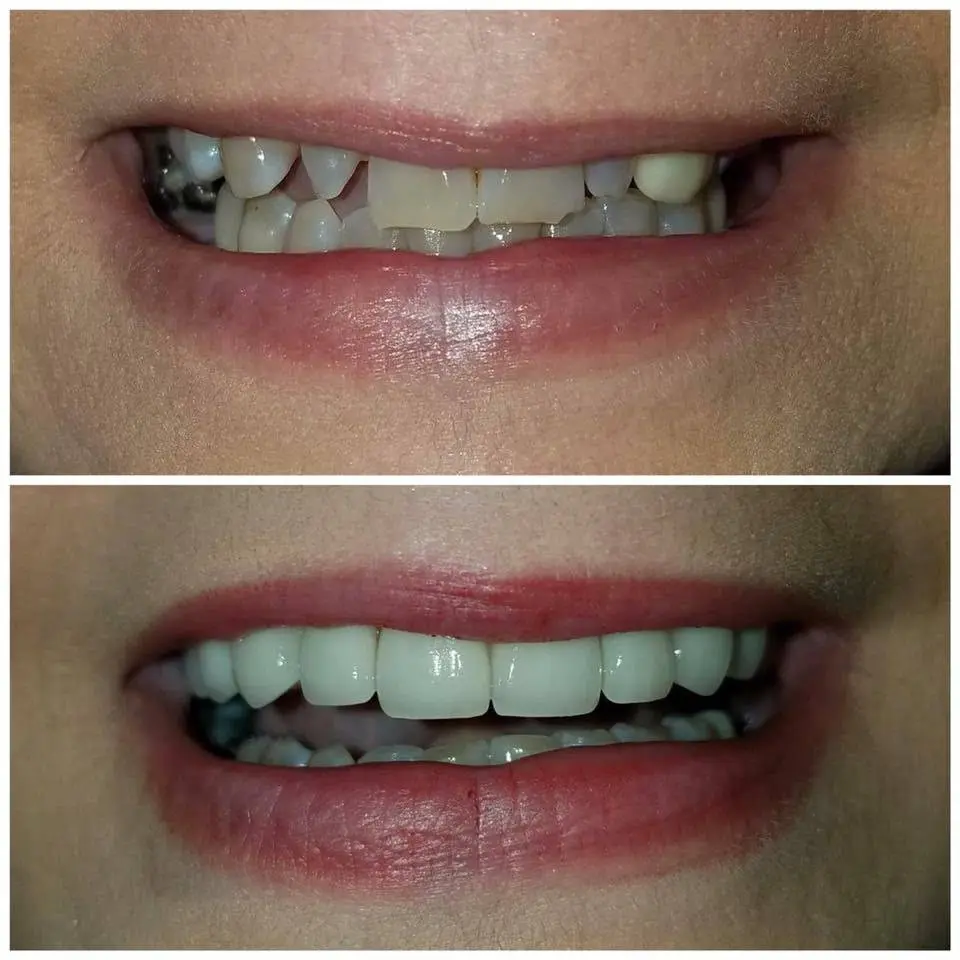 Lifetime Smiles