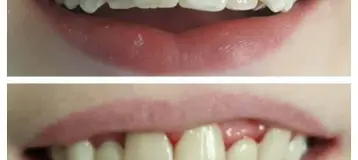 Dent-Al Smiles, LLC