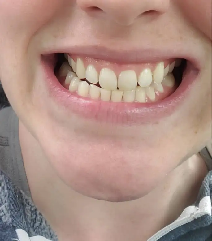 Augusto Fojas, DDS. Dentistry for Adults and Children