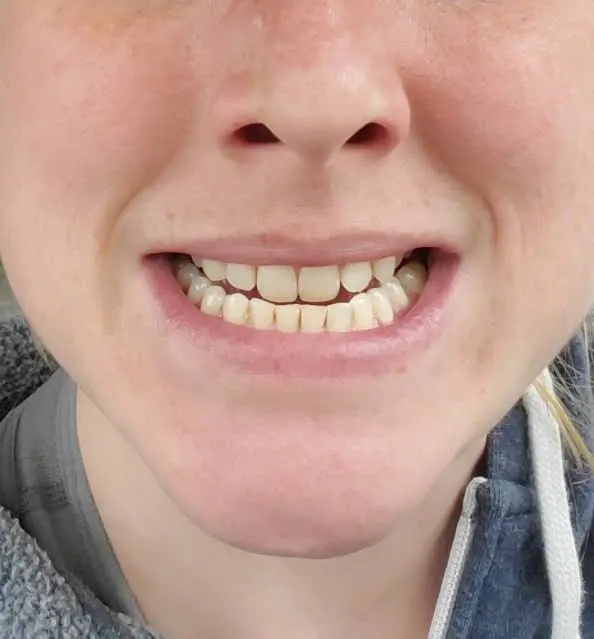 Augusto Fojas, DDS. Dentistry for Adults and Children