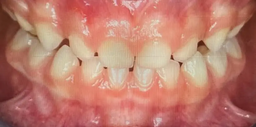 Bowen Legacy Dental