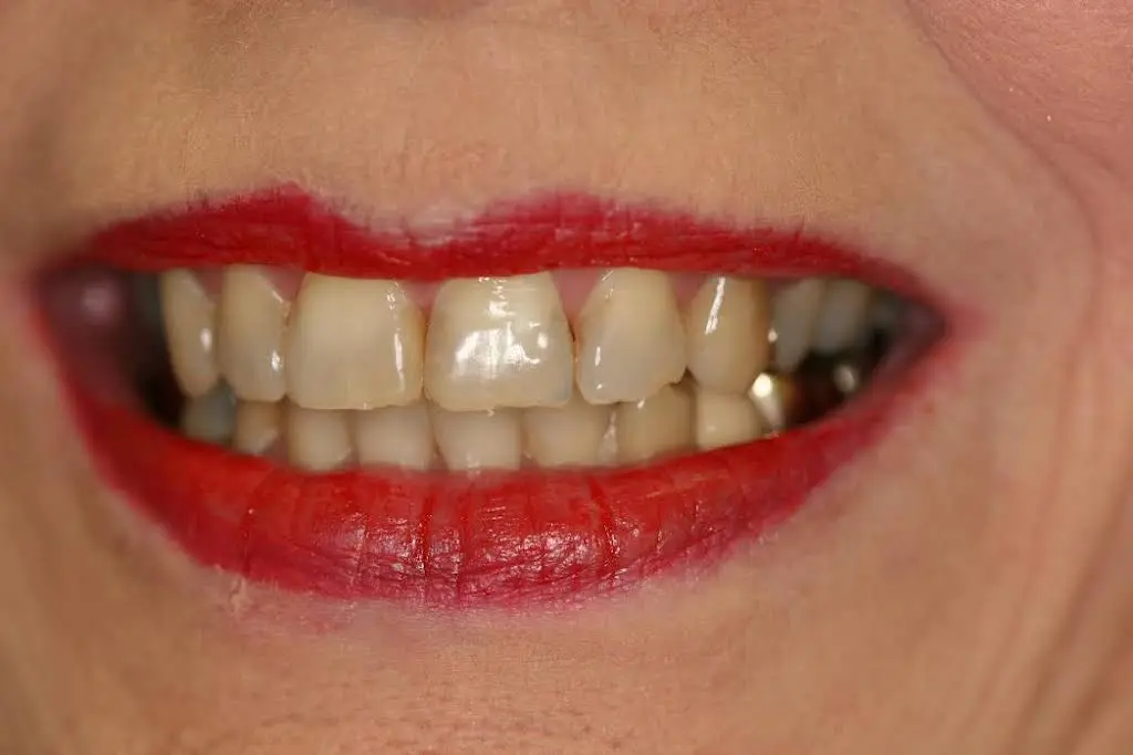 Canida Dentistry