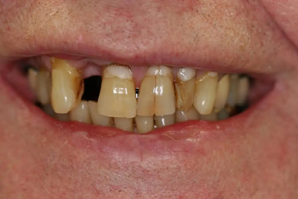Canida Dentistry