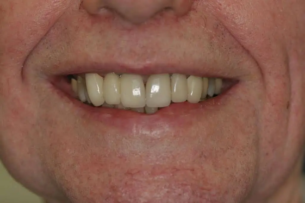 Canida Dentistry