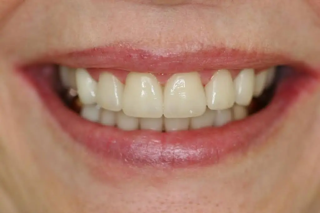 Canida Dentistry