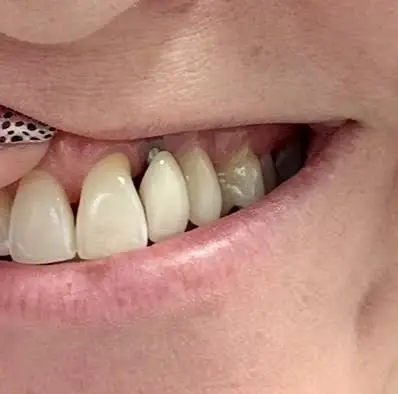 Mettens and Stewart Dental