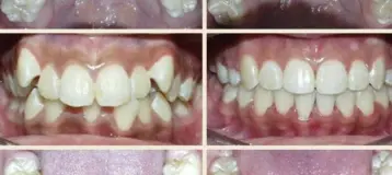 Johnson Orthodontics