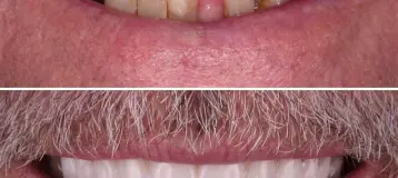 Velez Family and Cosmetic Dentistry