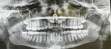 Amherst Oral Surgery and Implant Center