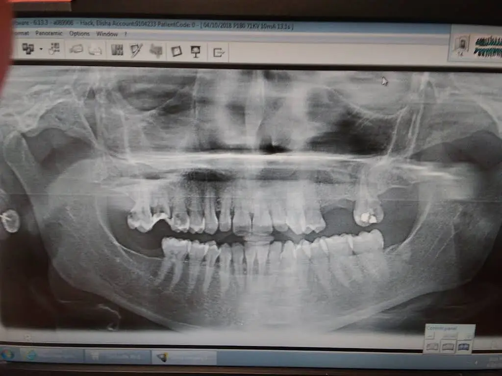 Aspen Dental