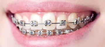 Emergency Dental Assistance