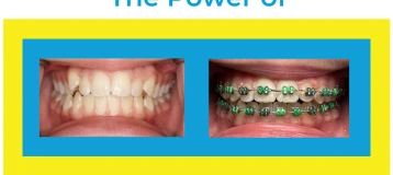 Mischler Orthodontics