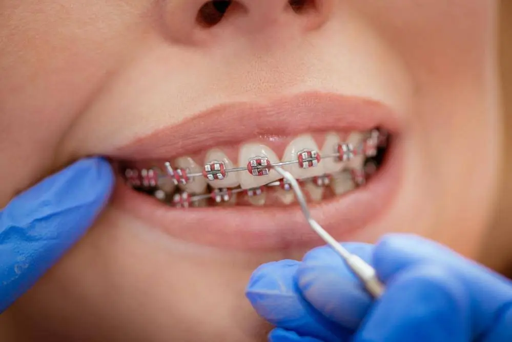 Precision Orthodontics