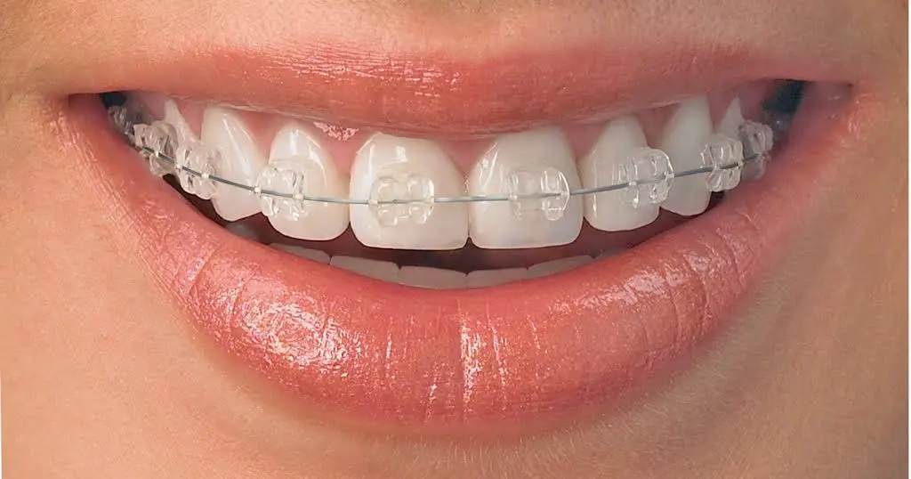 Chapman Orthodontics - Professional dental clinic exterior with modern facilities