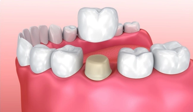 Kemper DMD Pediatric Dentistry - Professional dental clinic exterior with modern facilities