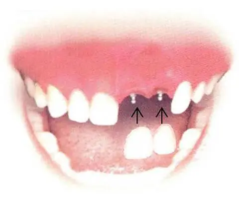 Dental Implant Solutions Parma Heights, OH - Professional dental clinic exterior with modern facilities