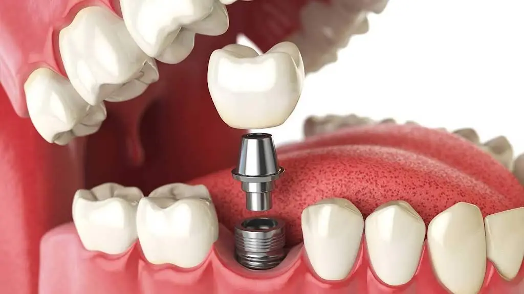 Louisville Oral Surgery & Dental Implants - Professional dental clinic exterior with modern facilities