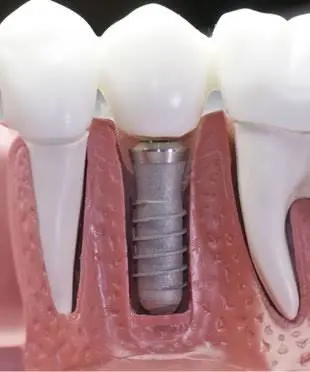 Advantage Dental & Dentures - Professional dental clinic exterior with modern facilities