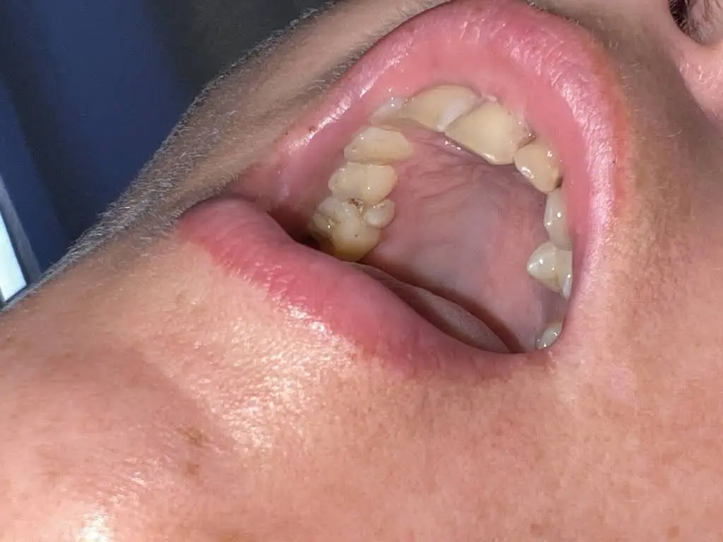 Ironton Denture Clinic - Professional dental clinic exterior with modern facilities