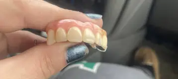 Affordable Dentures & Implants