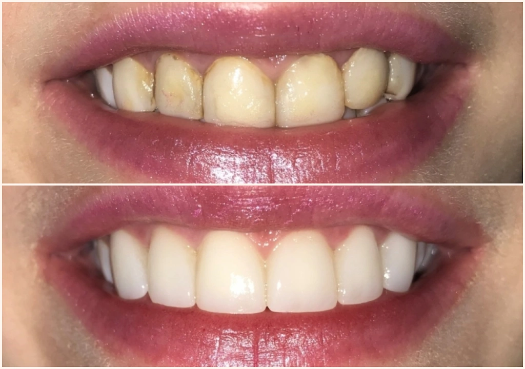 LaBuwi Crawford Dental Wellness LLC