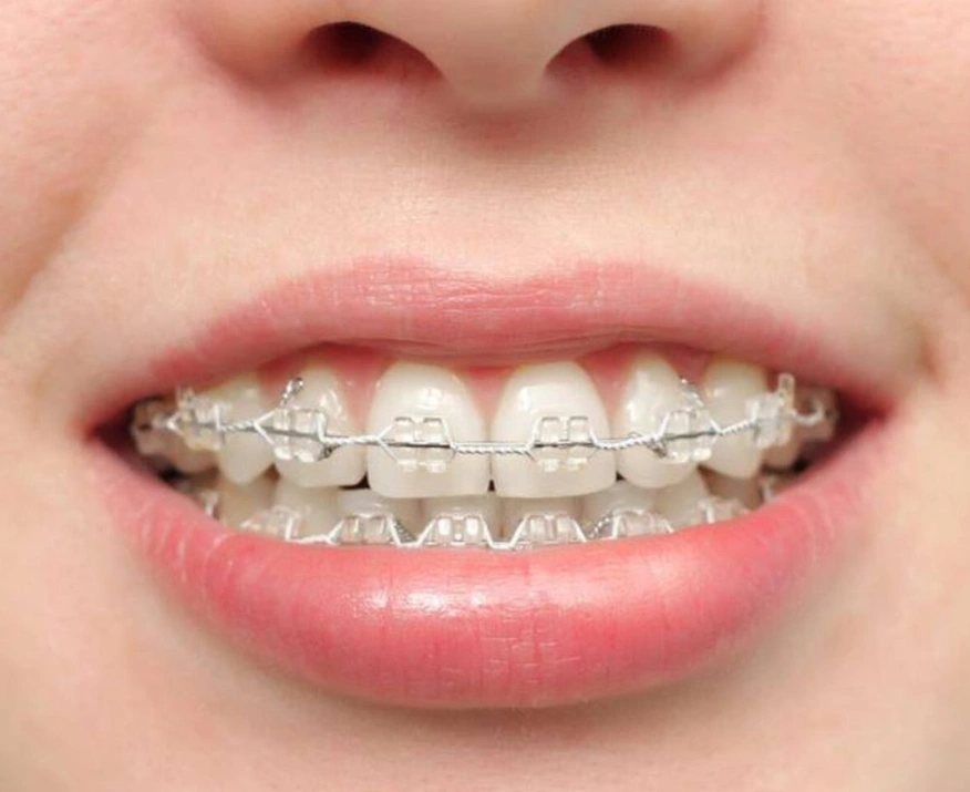 Nitro Family Dentistry
