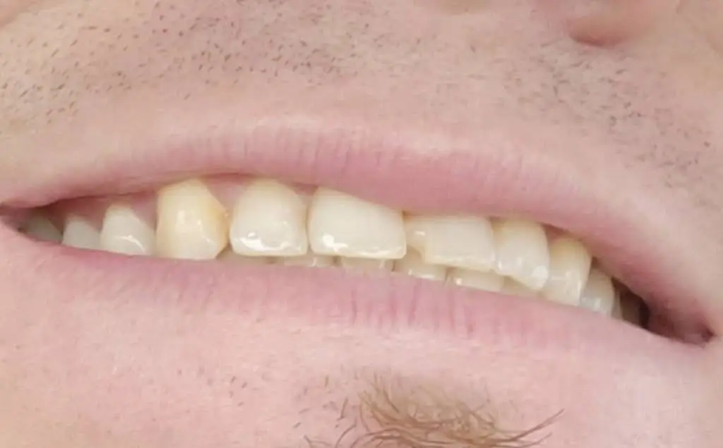 Dr. Phillip W. Wallace, DDS - Professional dental clinic exterior with modern facilities
