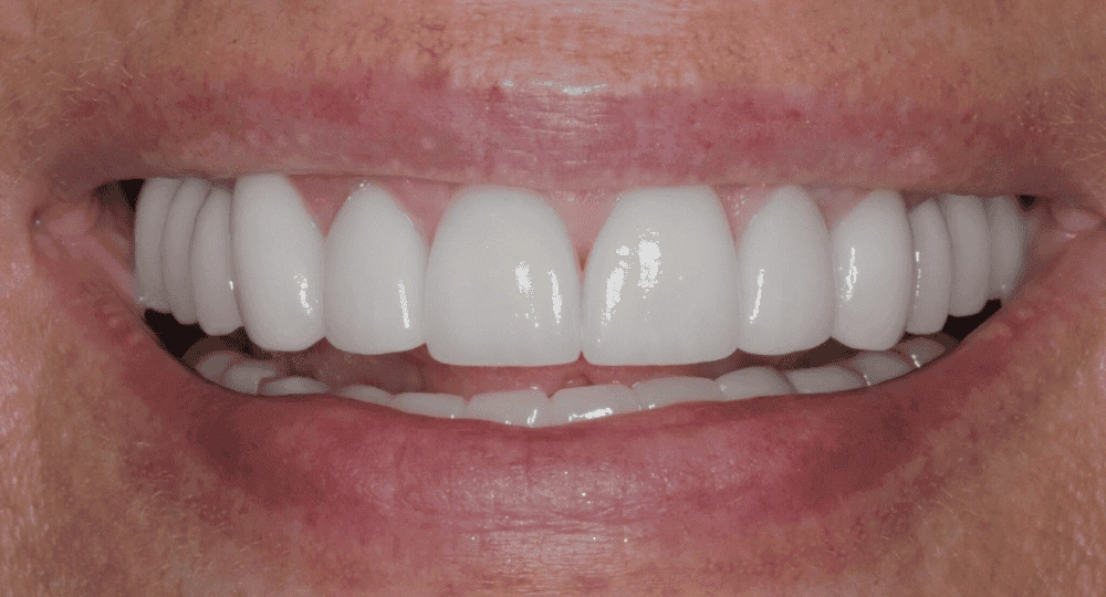 Gentle Dental - Professional dental clinic exterior with modern facilities