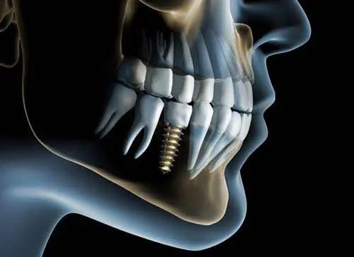 Metro West Dental & Implant Institute - Professional dental clinic exterior with modern facilities