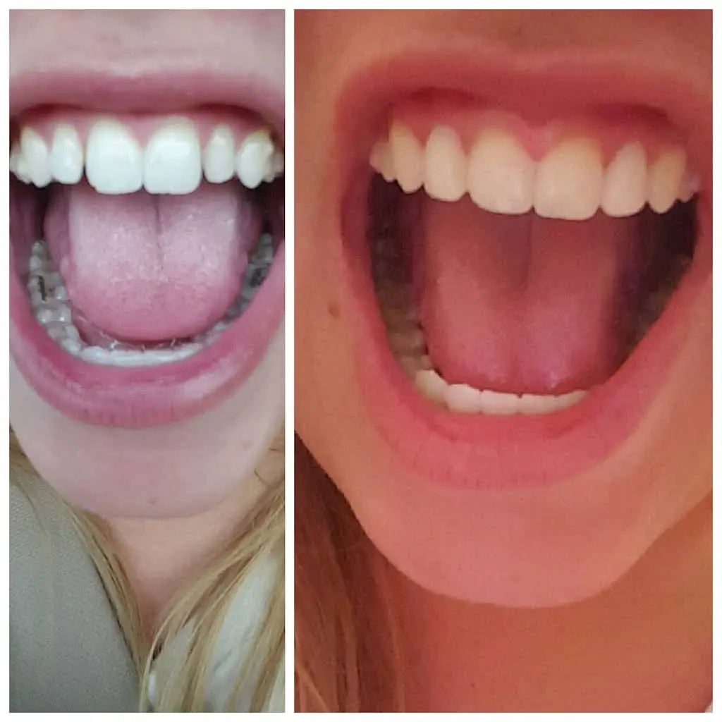 Hidden Creek Dental Care