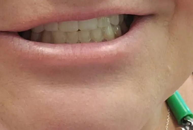 Frederick Family Dentistry