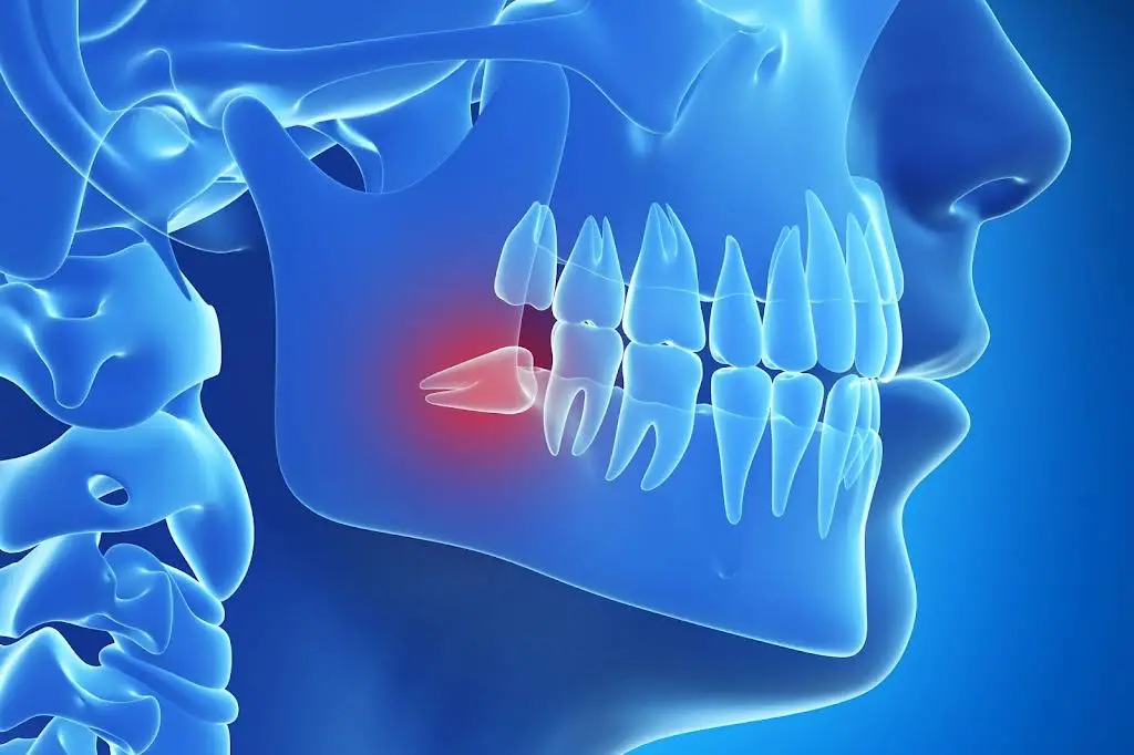 Midwest Oral Maxillofacial & Implant Surgery