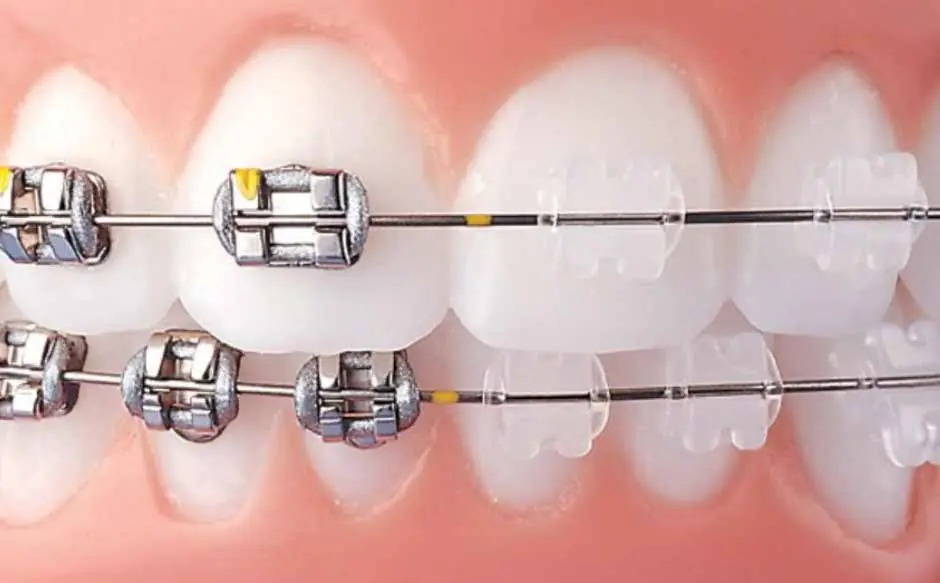 PearlFection Dentistry - Professional dental clinic exterior with modern facilities