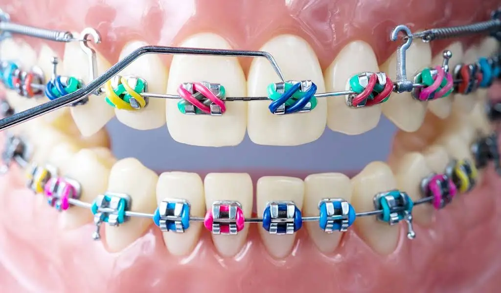 M&M Braces - Professional dental clinic exterior with modern facilities