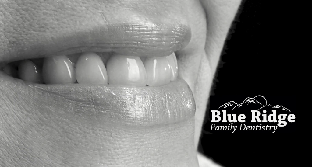 Blue Ridge Family Dentistry - Professional dental clinic exterior with modern facilities