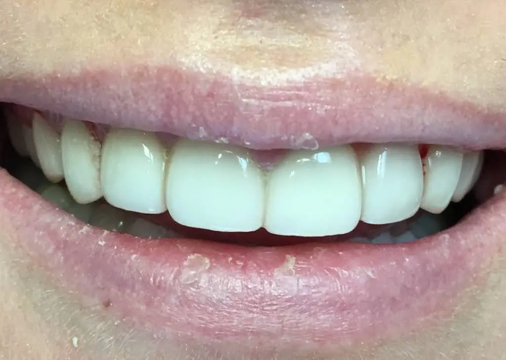 Summit View DDS - Professional dental clinic exterior with modern facilities