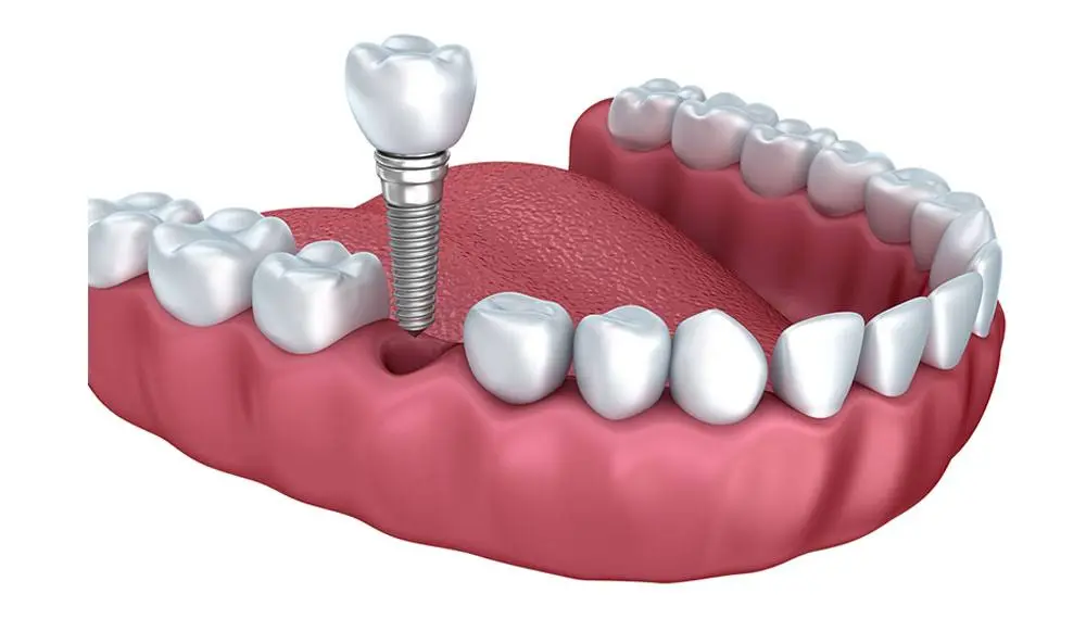 PearlFection Dentistry - Urbana - Professional dental clinic exterior with modern facilities
