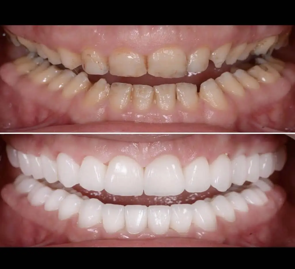 Laytonsville Family Dentistry - Dr. Harith Ali - Professional dental clinic exterior with modern facilities