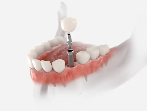 Urgent Dental Assistance Richmond - Professional dental clinic exterior with modern facilities