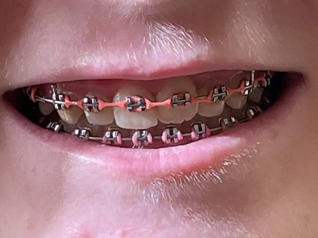Signature Smiles Orthodontics - Professional dental clinic exterior with modern facilities
