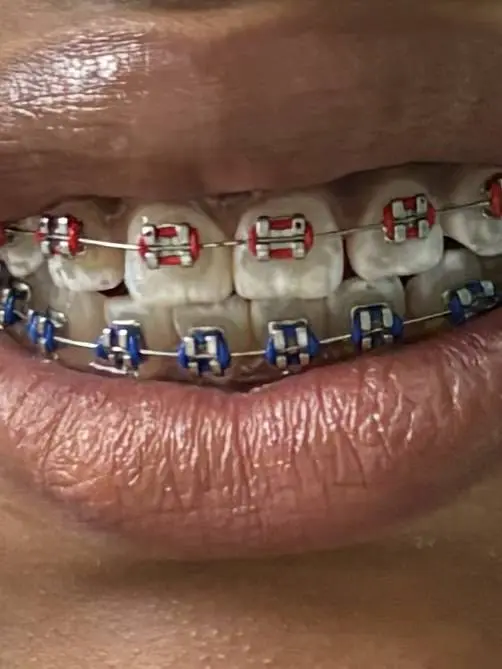 Signature Smiles Orthodontics