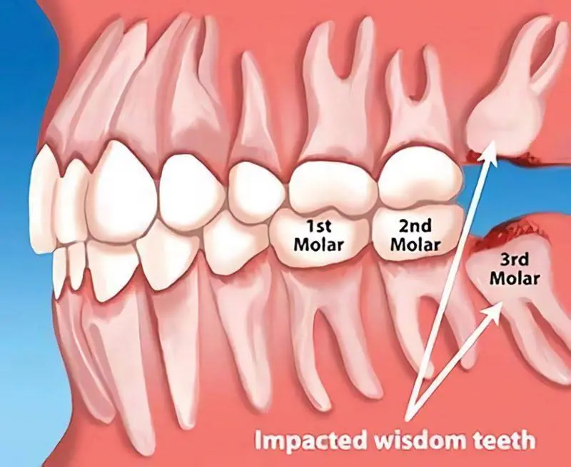Apex Dental