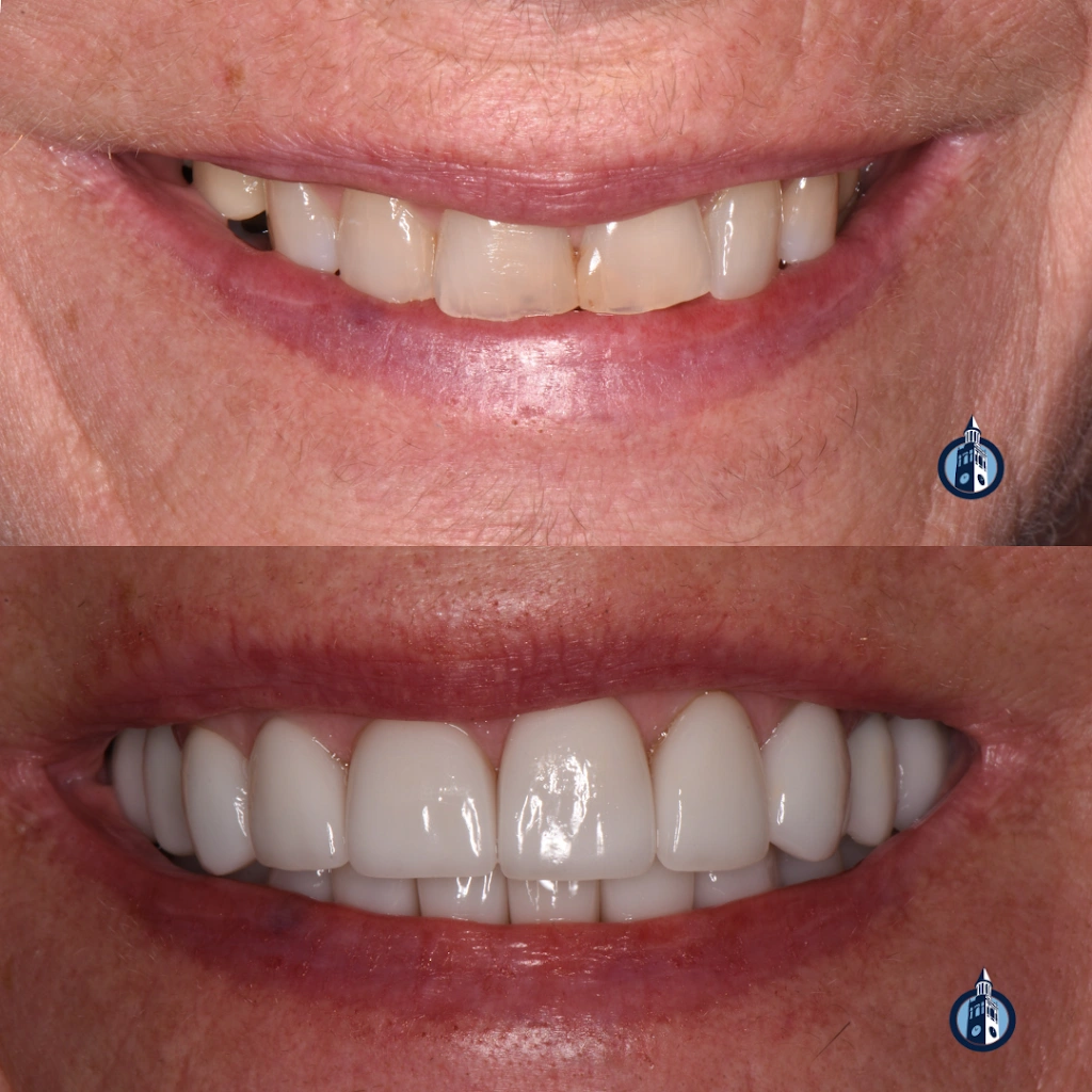 Chapel Hill Family & Cosmetic Dentistry: James Furgurson, DDS - Professional dental clinic exterior with modern facilities
