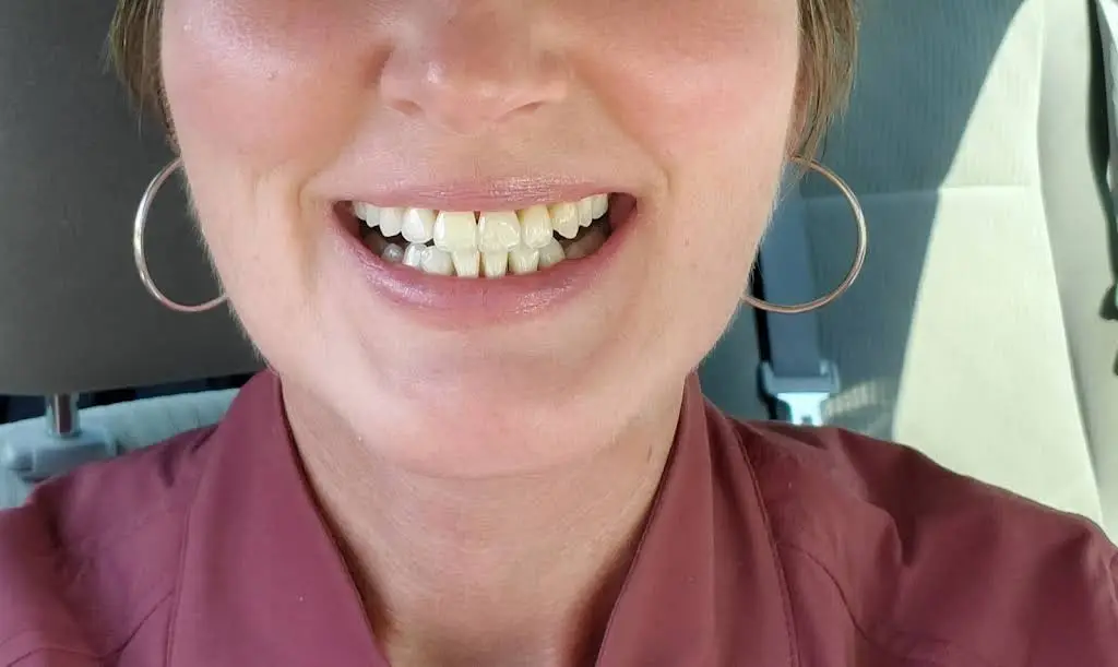 Dental Care Associates - Selinsgrove - Professional dental clinic exterior with modern facilities