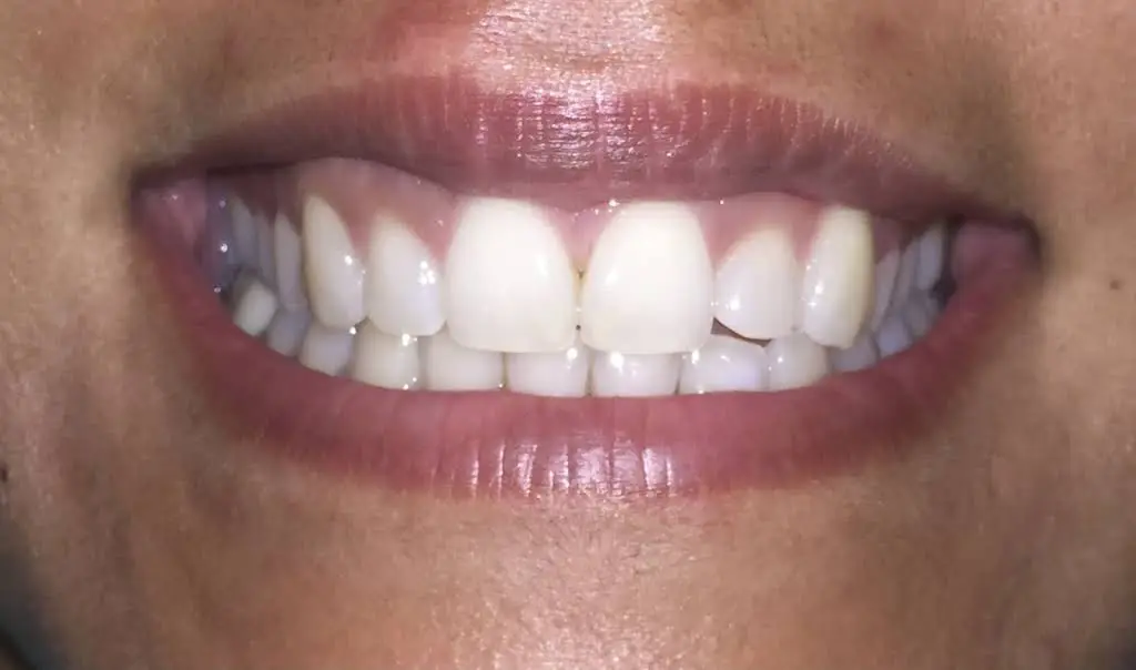 Smiles By Shaw - Professional dental clinic exterior with modern facilities