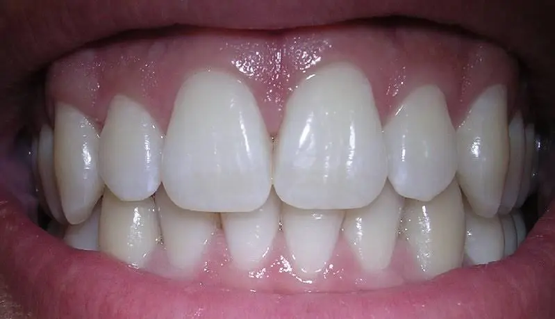 Lehigh Valley Sculpted Smiles: Michael E. Kun, DMD - Professional dental clinic exterior with modern facilities