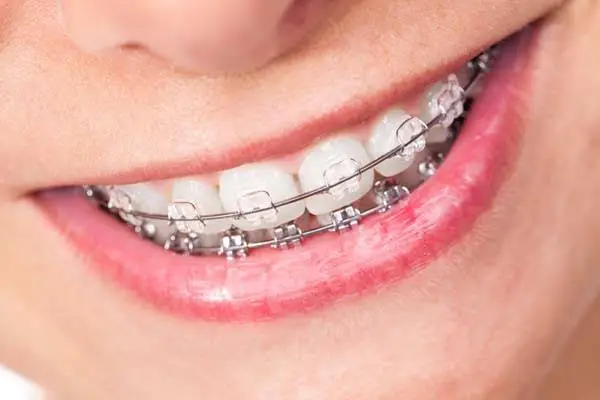 Henry Orthodontics - Professional dental clinic exterior with modern facilities