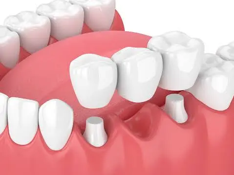DeWire Dental - Professional dental clinic exterior with modern facilities