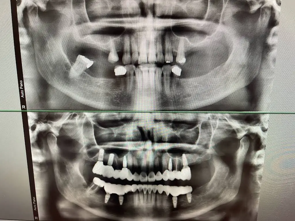 Myrtle Grove Implant and Family Dentistry - Professional dental clinic exterior with modern facilities